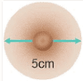 5 CM