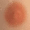 Light Brown Areolas