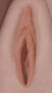 Tan Areolas