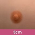 3 CM