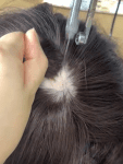 Implanted Hair +$225.0