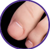 Toenails A