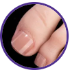Toenails B